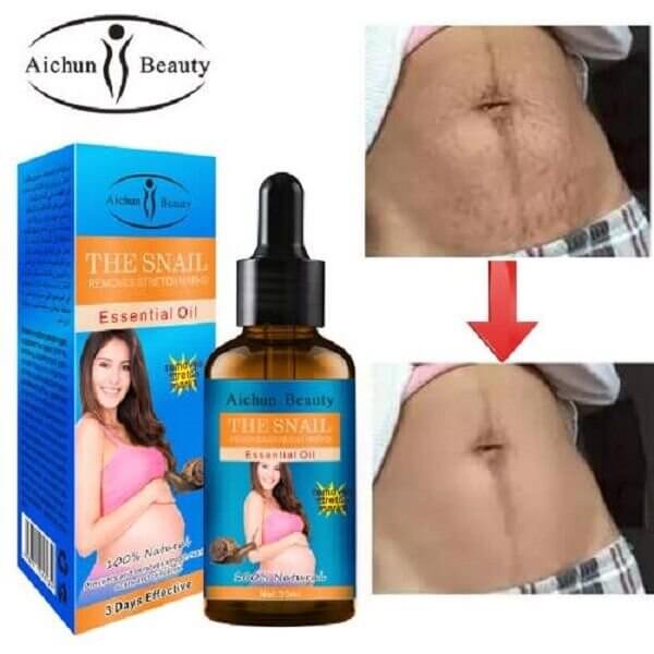 Perfect Dealz Snail Extract Stretch Mark Remover Essential