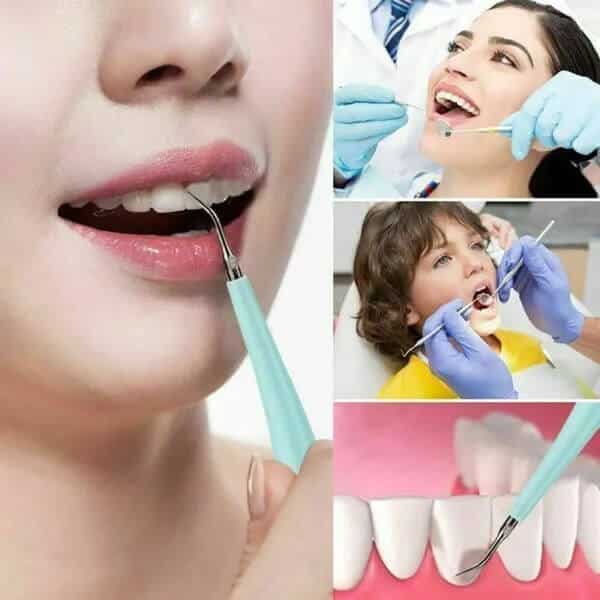 Perfect Dealz Electric Dental Teeth Whitening Kit
