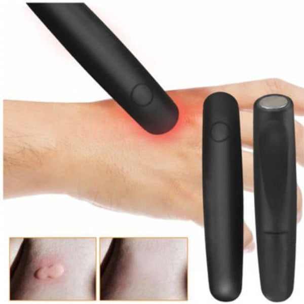 Electronic Bite Helper The Itch Terminator image 0