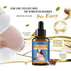 Perfect Dealz Snail Extract Stretch Mark Remover Essential