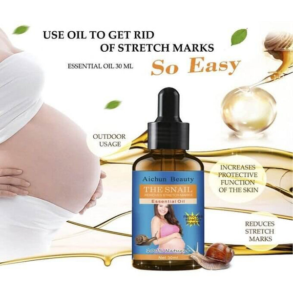 Perfect Dealz Snail Extract Stretch Mark Remover Essential