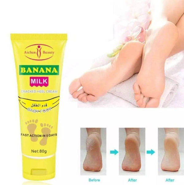 Cracked Heel Repair and Care Cream for soft, smooth, and healthy feet before and after results.