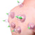 6 Pcs Chinese Body Cupping Massage Suction Therapy image 0