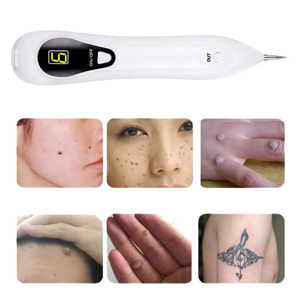 Perfect Dealz Beauty Mole Removal Sweep Spot Pen
