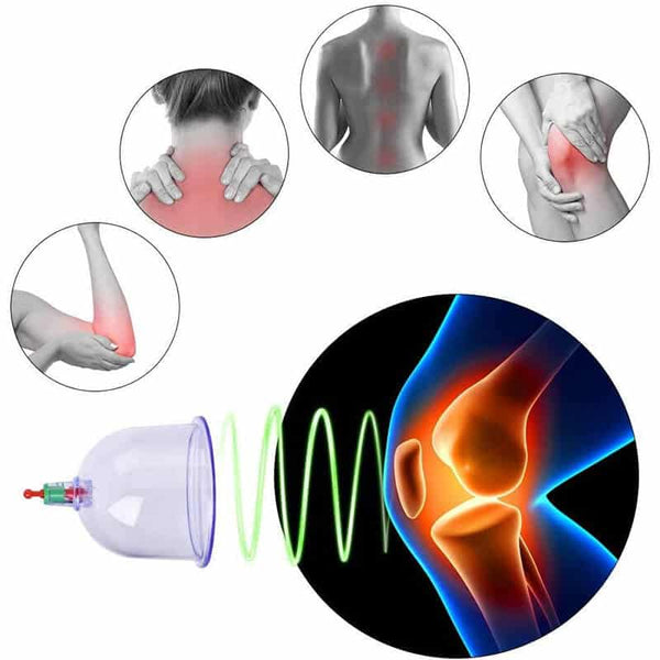 Chinese Cupping Vacuum 12pcs image 5