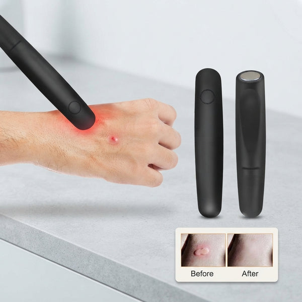 Electronic Bite Helper The Itch Terminator