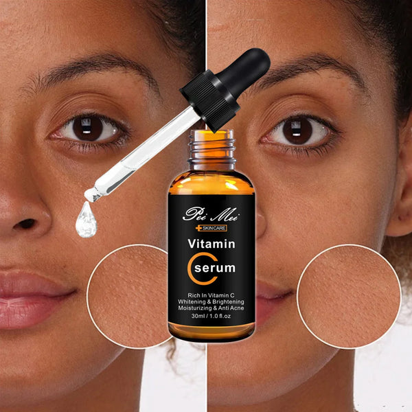 Vitamin C Brightening Face Serum in a dropper bottle with before and after skin comparison.