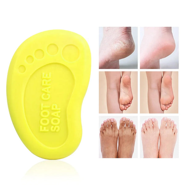 Beauty Banana Milk Mini Whitening Soap and foot care soap for healthier, more hydrated skin.