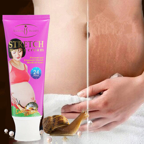 Perfect Dealz Snail Stretch Marks Cream