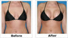 Before and after images showing results of Breast Enlarging Cream on bust appearance.